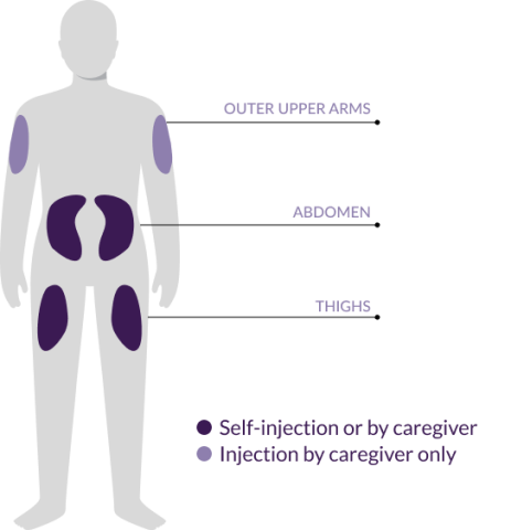 NEMLUVIO® may be administered via self injection or by a caregiver in the abdomen and thighs. NEMLUVIO® may be administered by a caregiver only in the outer upper arms.